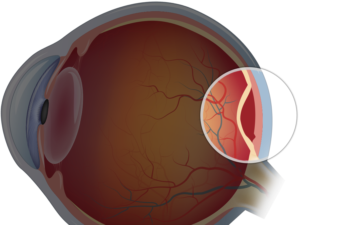 What is Retina in the Eye?