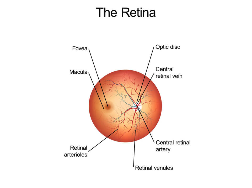 Retinal Vascular Disease Symptoms Retina Associates Kansas City